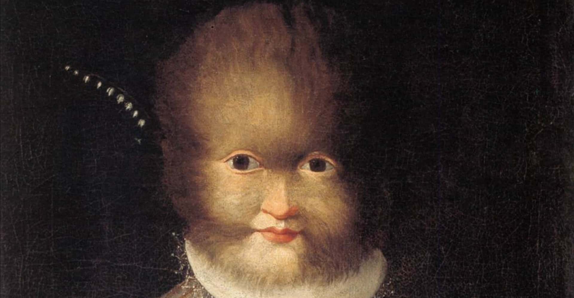 Il Ritratto di Antonietta Gonzales di Lavinia Fontana: la dignità dell'ipertricosi