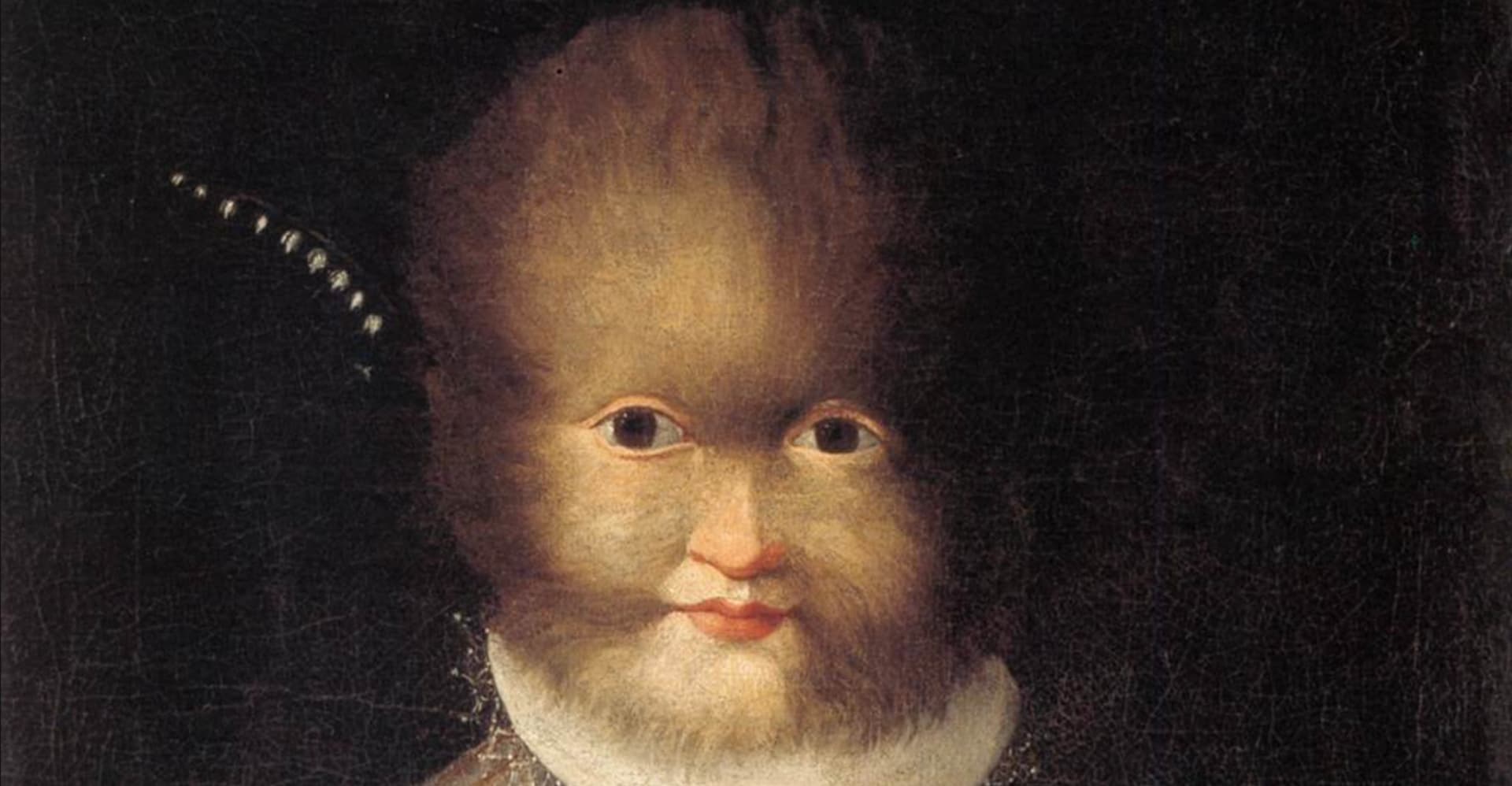 Il Ritratto di Antonietta Gonzales di Lavinia Fontana: la dignità dell'ipertricosi